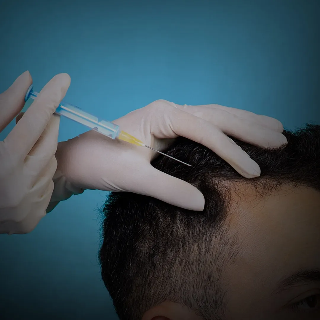 تیم پزشکی در حال انجام کاشت مو