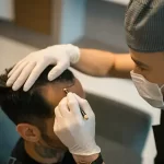 بهترین روش کاشت مو در سال ۱۴۰۴ کدام است؟