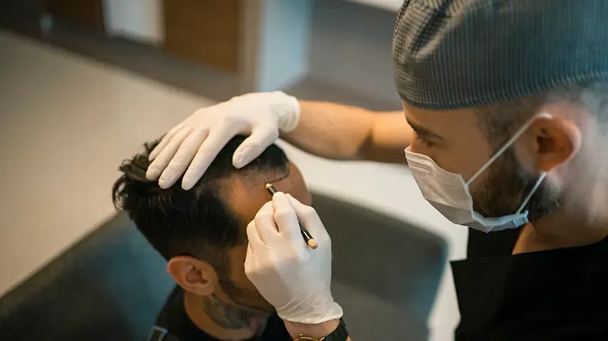 نمونه نتیجه کاشت مو طبیعی