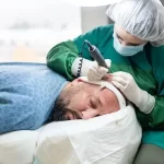 بهترین روش کاشت مو در تبریز برای آقایان