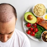 تغذیه مناسب برای بعد از کاشت مو