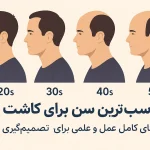 مناسب‌ترین سن برای کاشت مو؛ راهنمای کامل و علمی برای تصمیم‌گیری بهتر