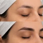 کاشت ابرو بدون جراحی در تبریز
