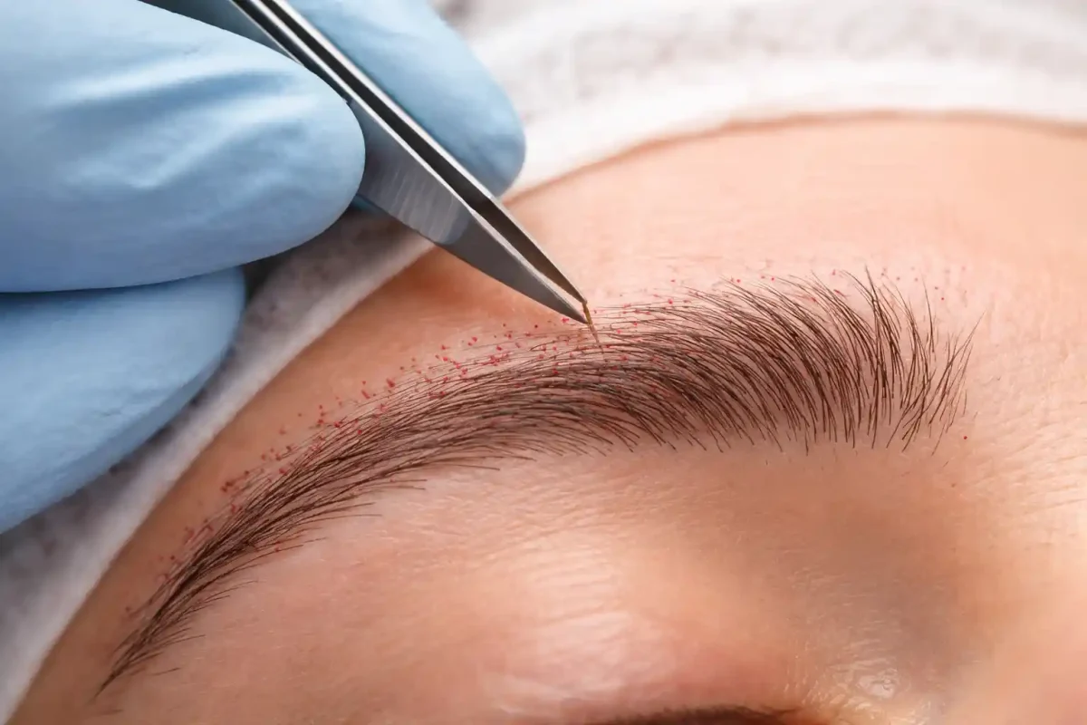 بررسی شرایط کاشت ابرو روی تاتوی قدیمی