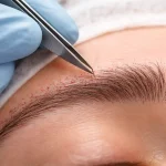 کاشت ابرو چیست و چگونه انجام میشود؟