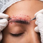 عوارض کاشت ابرو چیست؟ بررسی کامل ریسکها و نکات ایمنی
