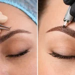 کاشت ابرو بهتر است یا میکروبلیدینگ؟ مقایسه تخصصی، علمی و کاربردی