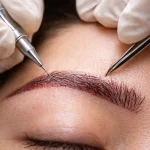 کاشت ابرو طبیعی روی تاتو؛ بررسی علمی، فنی و اجرایی یک راهکار نوین ترمیم ابرو