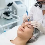 کاشت ابرو برای ابروهای نامتقارن؛ چگونه قرینگی ایجاد میشود؟