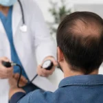 آیا کاشت مو برای افراد مبتلا به فشار خون بالا مناسب است؟ شرایط، خطرات و نکات مهم